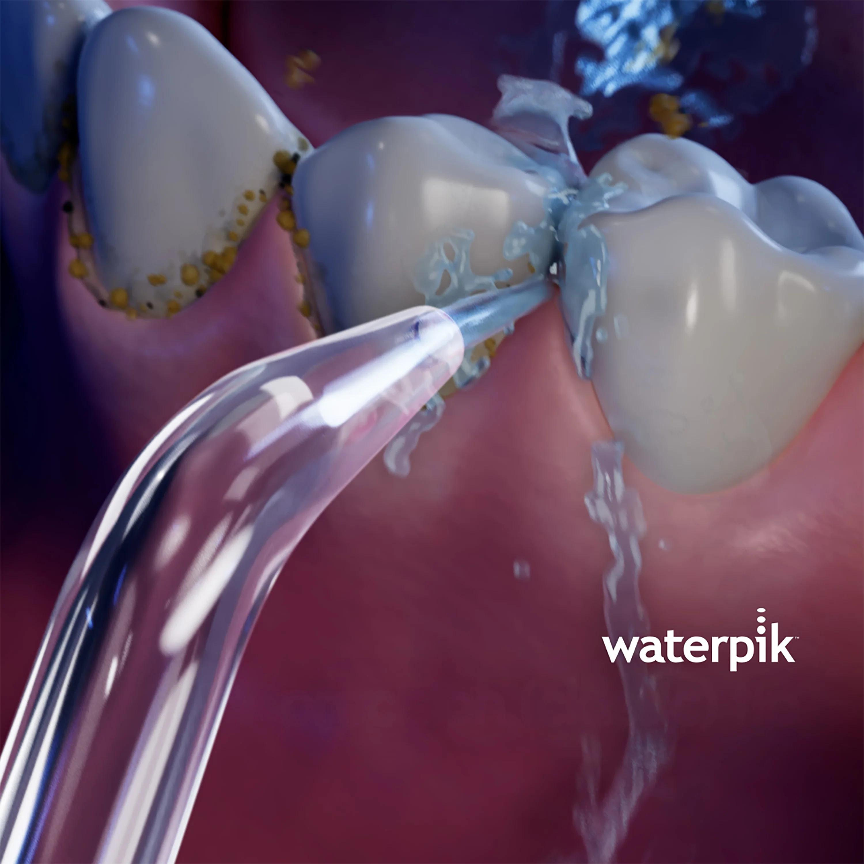 Classic Tip (fits Classic water flossers only) - Image 3