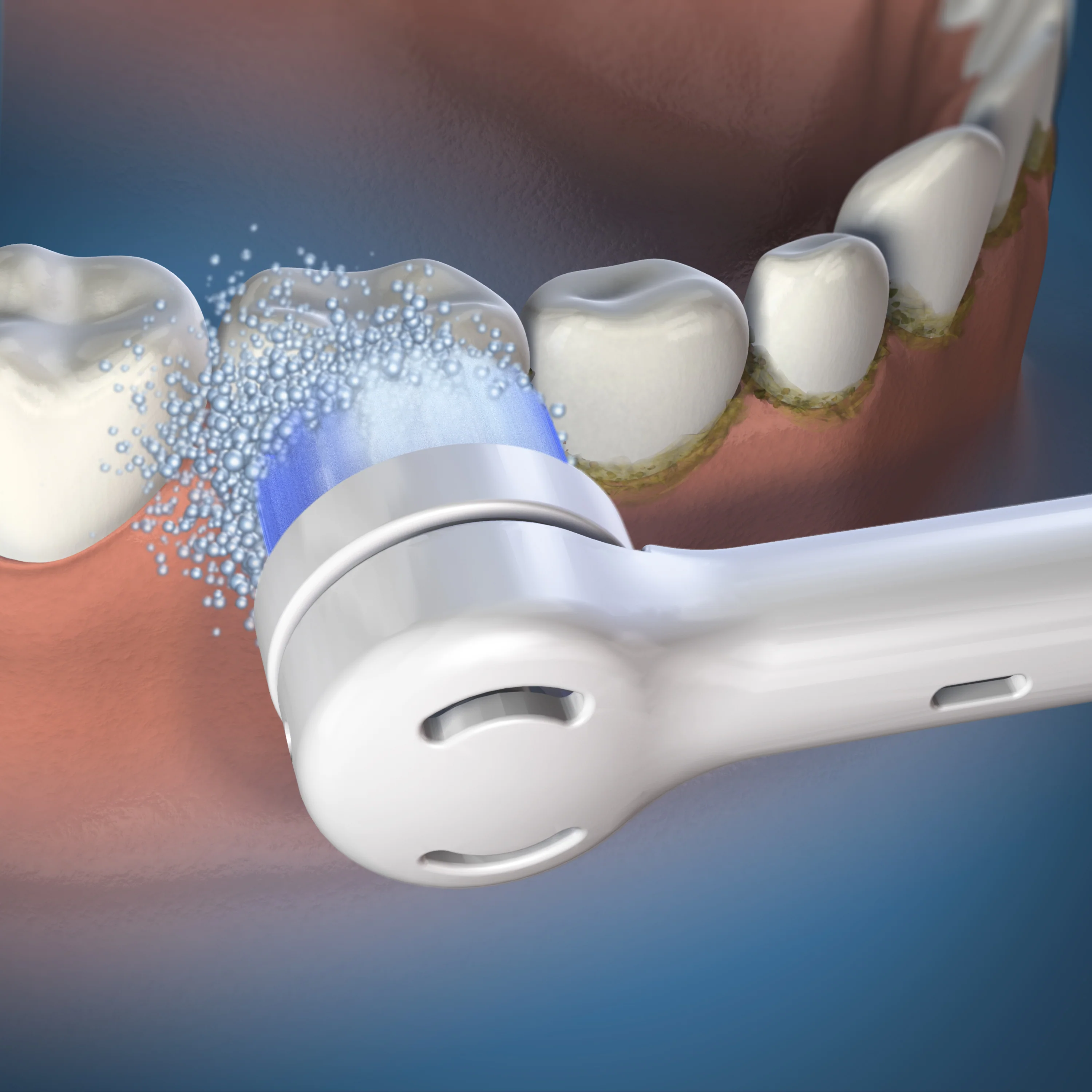 Triple Clean Replacement Brush Heads - Image 3