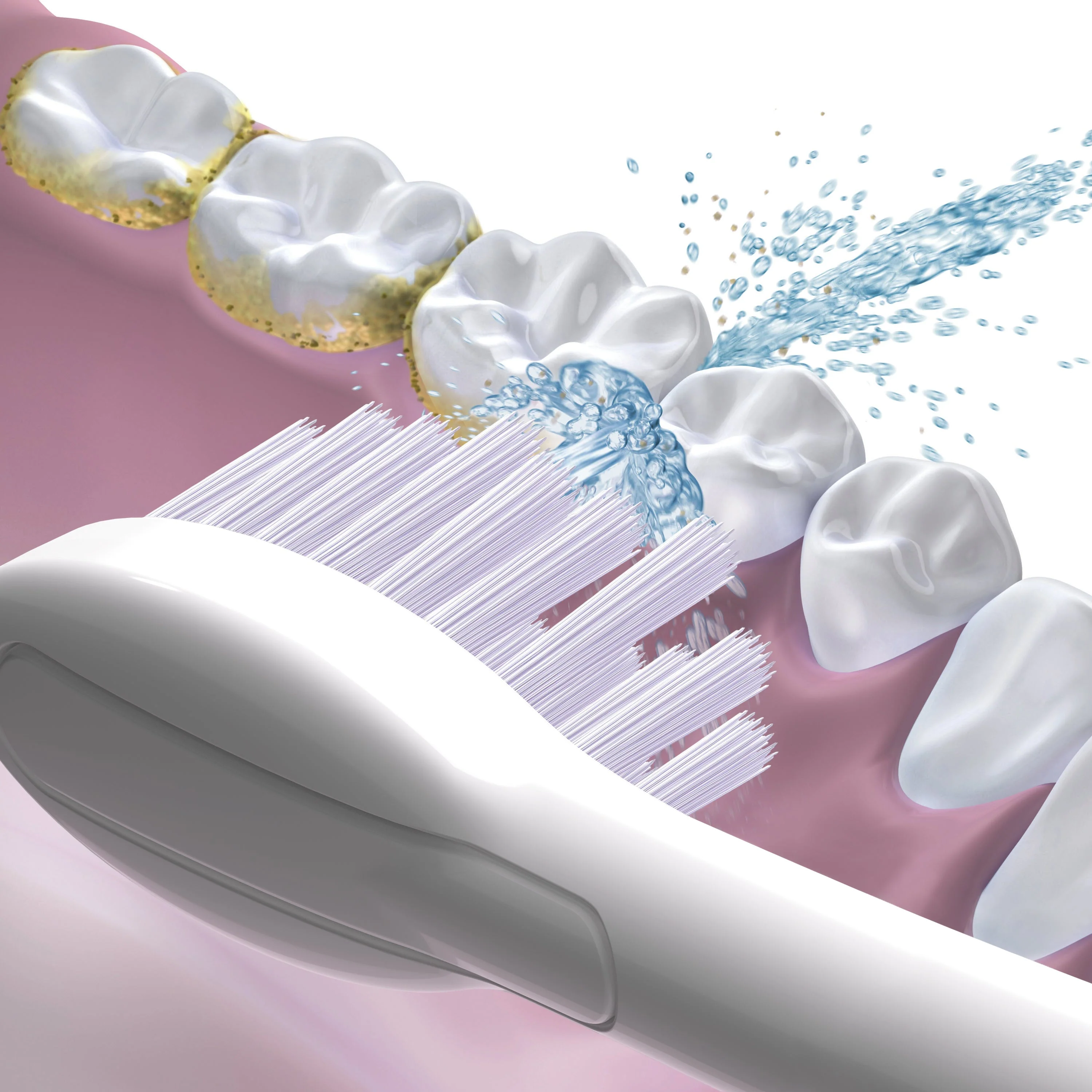 Sonic-Fusion™ Compact Replacement Flossing Brush Heads (4 pack - 2 per package) - Image 4