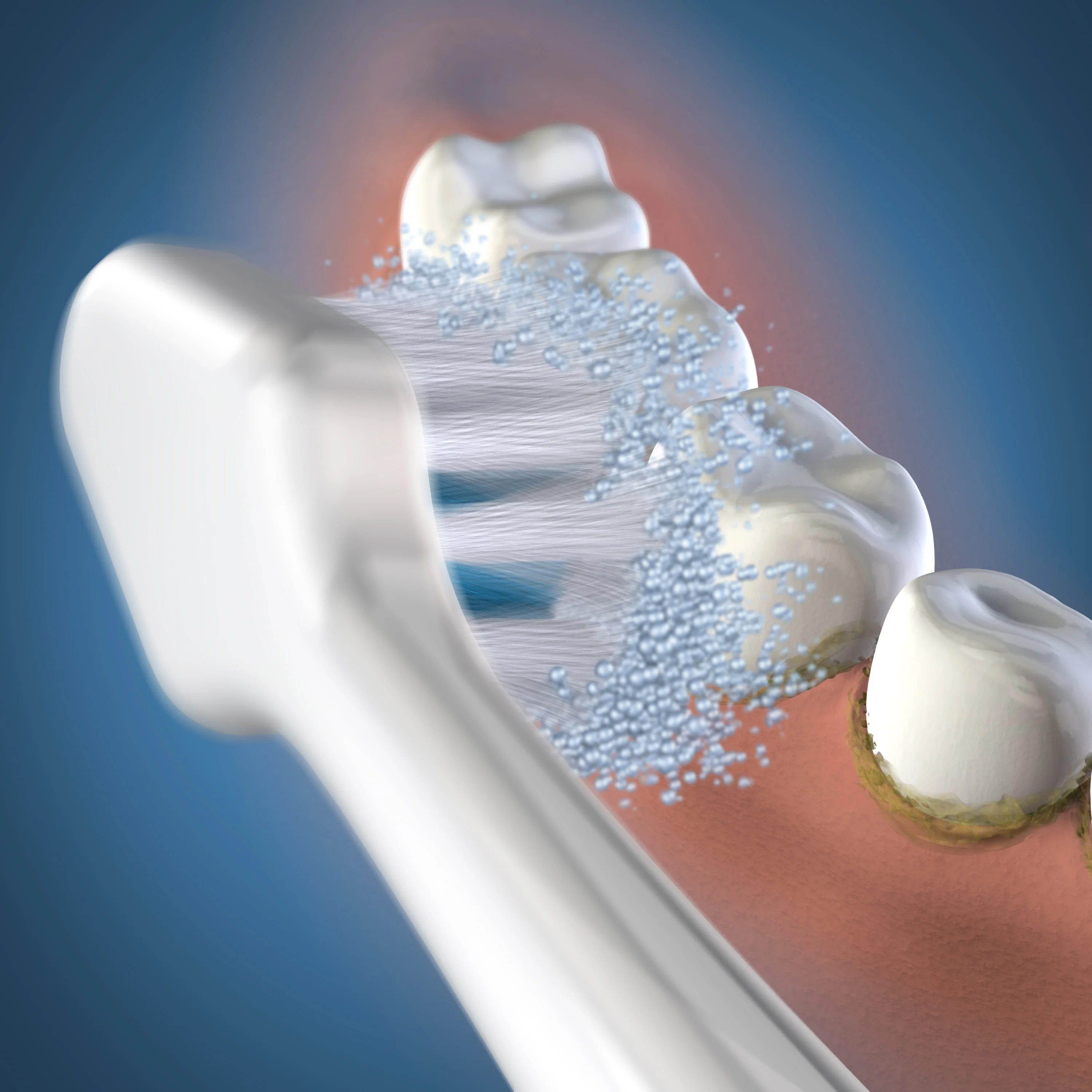 Triple Sonic Replacement Brush Heads - Image 3