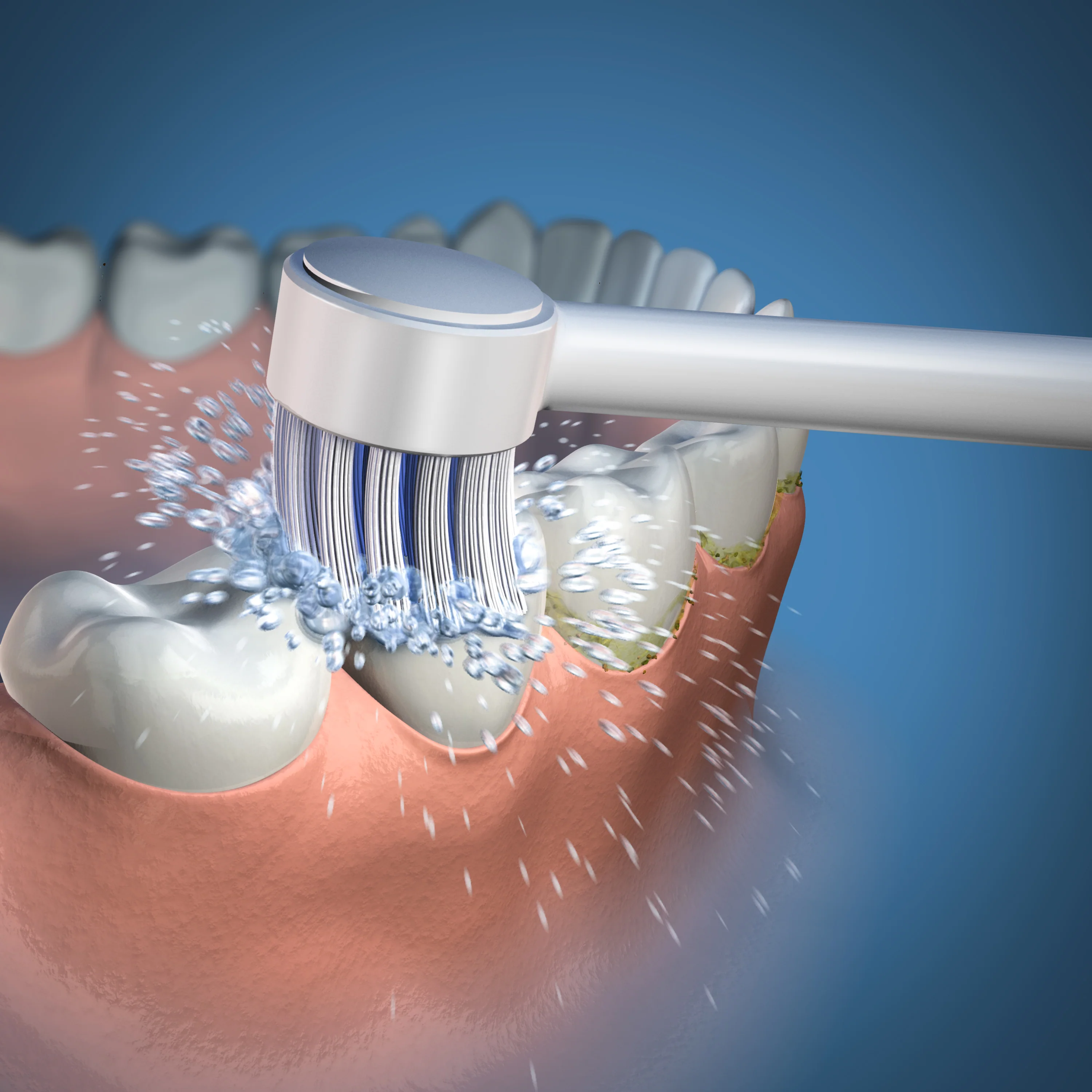 Water Flosser Toothbrush Tip - Image 3